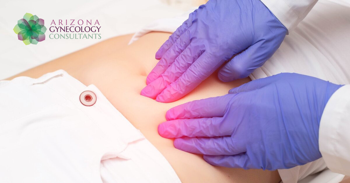 Sonata Fibroid Treatment