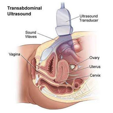 pelvic ultrasound