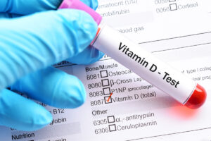 Blood tests can reveal low vitamin D