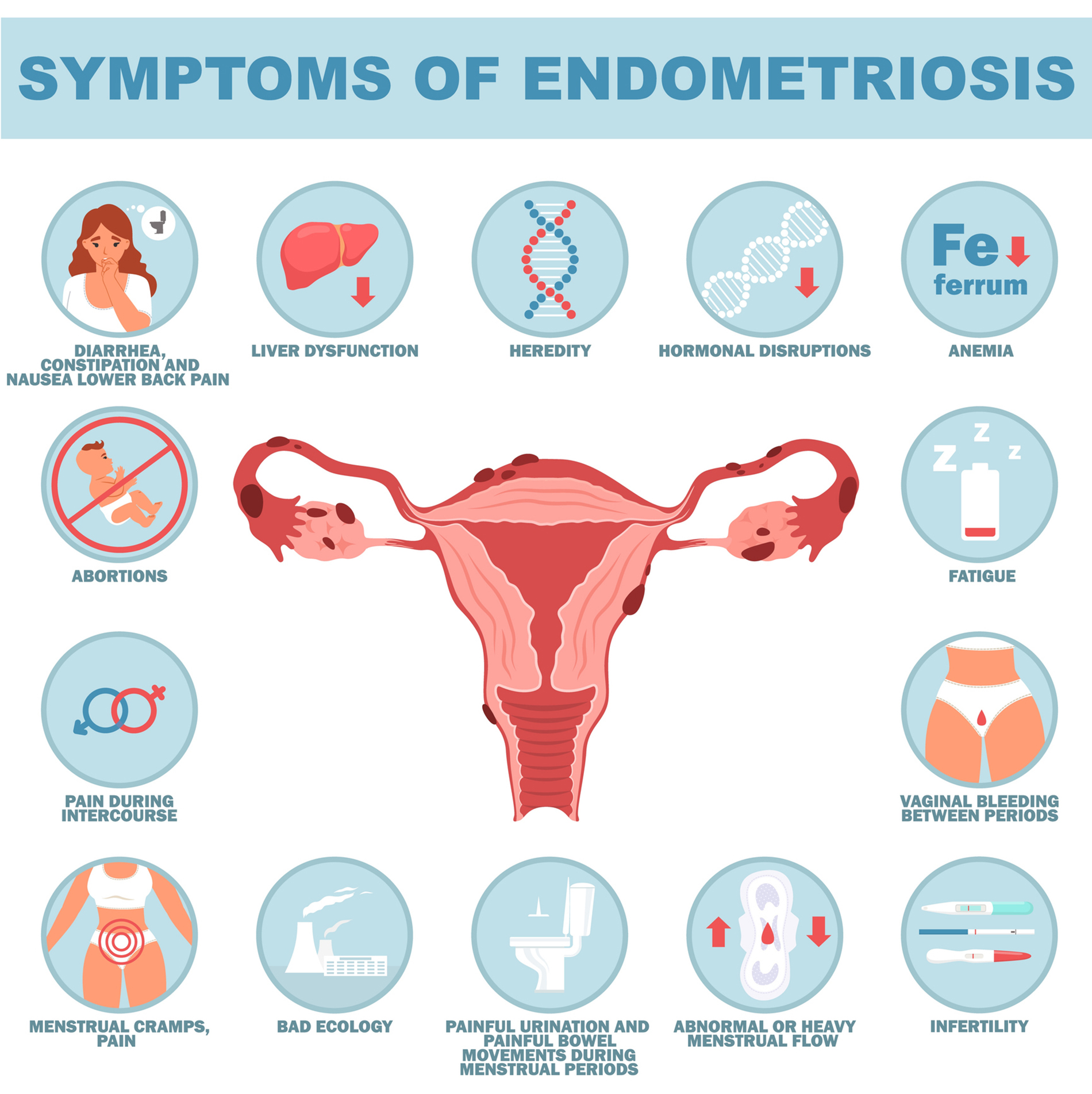 Endometriosis Symptoms