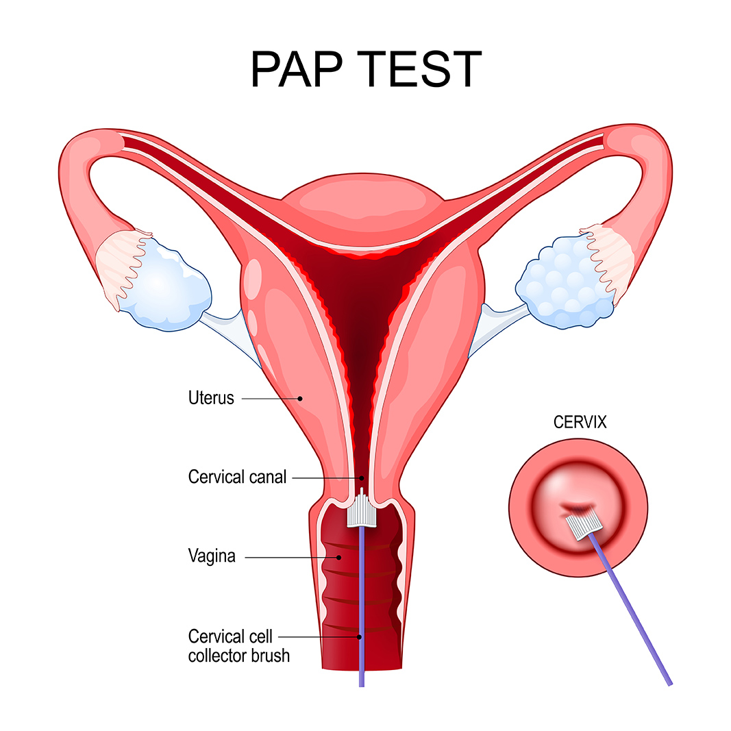 Pap Test